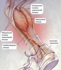 Растяжение ноги: симптомы и лечение